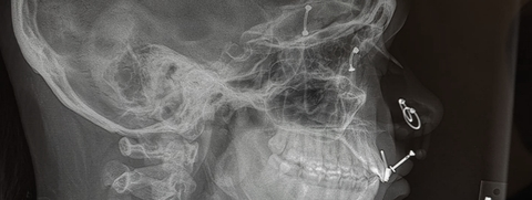 Leaked macadamiacookie header onlyfans leaked