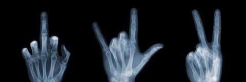 Leaked medicalmuscle2020 header onlyfans leaked