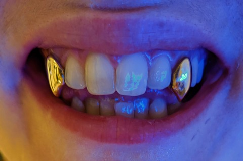 Leaked mysterymullet header onlyfans leaked