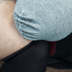 Leaked notoesnoleftleg onlyfans leaked